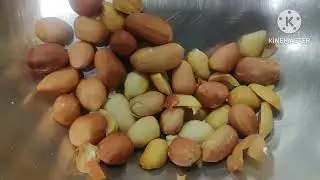 17/1/26 అపూర్వ కుట్రతో శివ నిశ్చితార్థానికి వస్తానని శరత్చంద్ర చెప్పడంతో ఆనందంలో భూమి