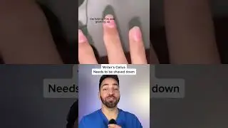 #duet with @_.whomee  who else has this? #dermdoctor #writersbump #writerscallus #DermDoctor #short