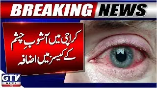 Karachi Faces Surge in Eye Infection Cases | Conjunctivitis Outbreak | Breaking News