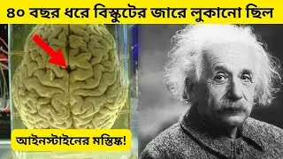 This One Piece Of Brain Changed The History Of Science! Why Was Einstein's Brain So Different?