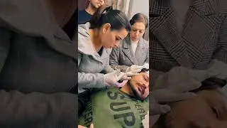 Face contouring by Botox  at Dr kasana clinic