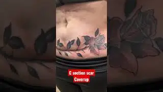 C Section Scar tattoo coverup #shorts