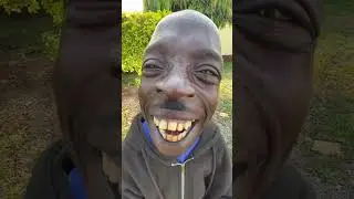 black boy big lips 🤣🤣 black boy comdey #shorts #funny #comedy #youtubeshorts