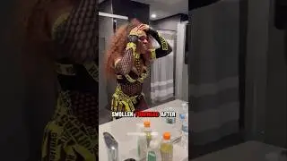 Наоми демонстрирует опухший лоб после SmackDown!