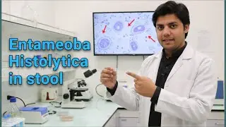 Entamoeba Histolytica protozoa in Stool: Microscopic and Parasitic examination of Stool