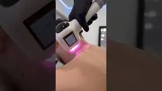 Лазерная эпиляция / Диодный лазер 2023 NEW. С сенсорной манипулой