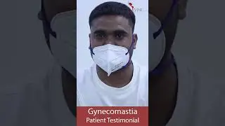 Testimonial of Gynecomastia Surgery