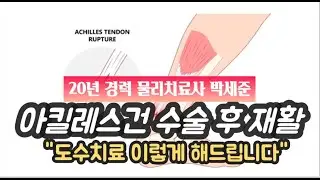 (도수치료) 아킬레스건수술재활/Achilles tendon Rehabilitation -