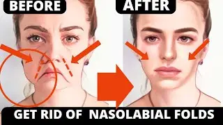 No Fillers Needed! Reduce Nasolabial Folds in 2 Weeks | Face Yoga for Laugh Lines