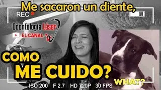 Me sacaron un diente, COMO ME CUIDO? – Odontología Láser