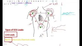 ECG Part 2 : 12 Leads Explained 