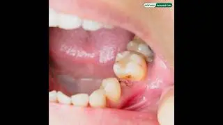 Oral microbiome friendly, natural, safe & mild | Toothpaste & Oral Care kit | Edinora Personal Care