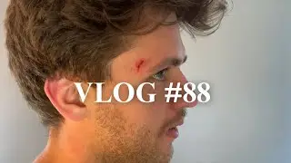 Vlog #88 | Baby drew blood | 100 days of vlogging