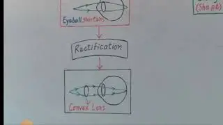 Disorders of Eye (Fully in English)