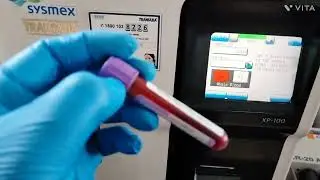 Cbc machine operating// sysmex // Erba#pathology #cbc #laboratory