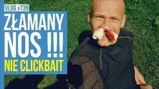 ZŁAMANY NOS!!! nie clickbait / VLOG #739