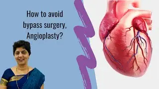 विना शस्त्रक्रिया हृदय उपचार | How to avoid bypass surgery, Angioplasty? | ज्योत्स्ना पाटील