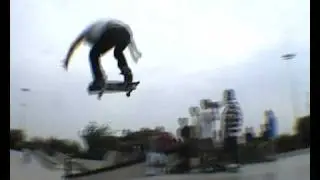 Ronny Calow, first trick tried after snapping his leg in two