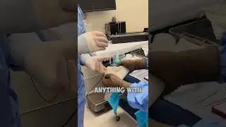 Как надевать перчатки на ОПЕРАЦИЮ! 🤯 #шорты