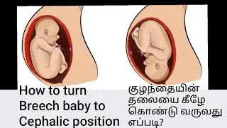 How to turn baby to HEAD DOWN position with some tricks | குழந்தை தலை திரும்ப