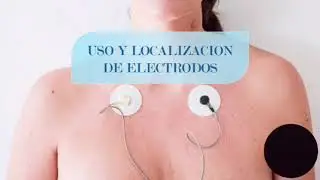 Caso clinico miocarditis | Urgencias m&eacute;dico quir&uacute;rgico 