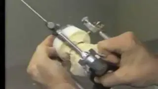 Setting Anterior Teeth for Immediate Maxillary Denture
