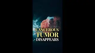 Do You Believe God Can Heal? | Healing Testimony #Shorts