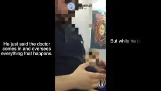 FUE Hair Transplant in Turkey Undercover Part 2 - Not the Baldness Cure 2018