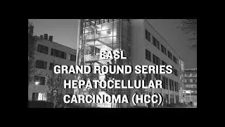 EASL Grand Round Series: Hepatocellular Carcinoma (HCC)