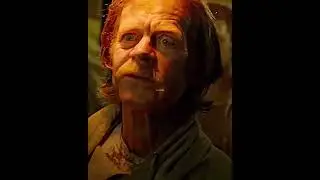 the quality slayed | frank gallagher edit | shameless | #trending #shorts #viral #shameless #edit