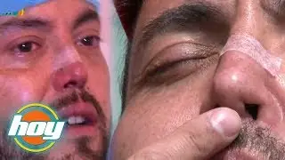 HOY | Mauricio Clark recuper&oacute; la nariz que le destruy&oacute; el consumo de drogas