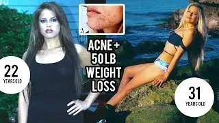 Benefits Of Going Vegan ♡ Update After 7 Years - Weight, Acne, ADD & More