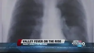Arizona, Pima County see spike in Valley Fever cases