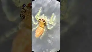 Baby Jumping Spider under microscope reveals telescopic eyes!