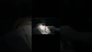 Может ли потеряться восприятие глубины после операции по удалению катаракты на одном глазу?