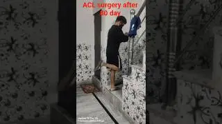 ACL surgery after 80 day #aclrecovery #kneeinjury #bending #recoverymotivation #exercise