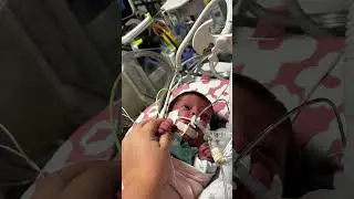 Click the link in my bio to donate and help save my baby's life. #SaveDaniela #OxygenSupport #Medica