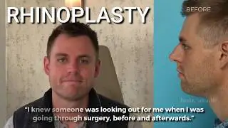 Patient Perspective of Rhinoplasty | Dr Patrick K Sullivan