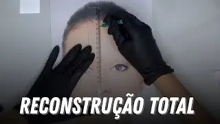 Como fazer reconstrução total das sobrancelhas