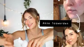 AKNE Guide zur reinen Haut| Pt1 richtige Hautpflege