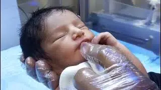 Baby Feeding Time With Umbilical Infection | Safe Care & Healing in NICU 🍼👶