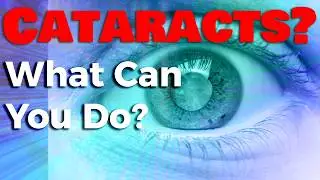 Slow Cataract Progression with These Natural Strategies | Eye Health