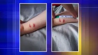 4-year-old boy comes home from school with gashes on wrist