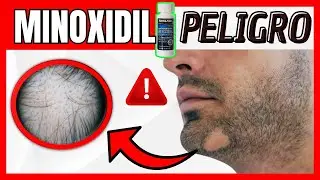 ✅ MINOXIDIL y BARBA 🧔 Efectos adversos 🧑‍🎓TECH Universidad Tecnológica