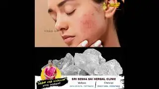 முகப்பருவை போக்கும் படிகாரம் | Alum stone as antiseptic for acne