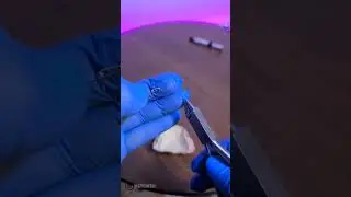 Orthodontics Z Spring making تعلم كيف تصنع ال