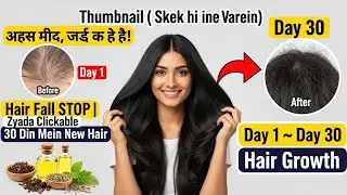 Overnight Hair Regrowth Serum | Bald Patches & Receding Hairline ke Liye Natural Remedy #haircare 