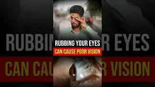 Can Rubbing Your Eyes Harm Your Vision?