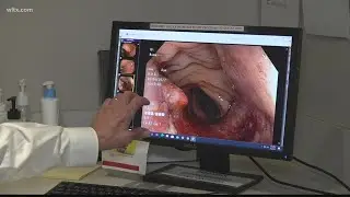 Experts share the best practices for preventing colon cancer