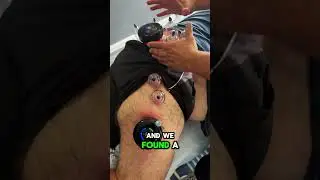 Global Tension = Localized Pain?